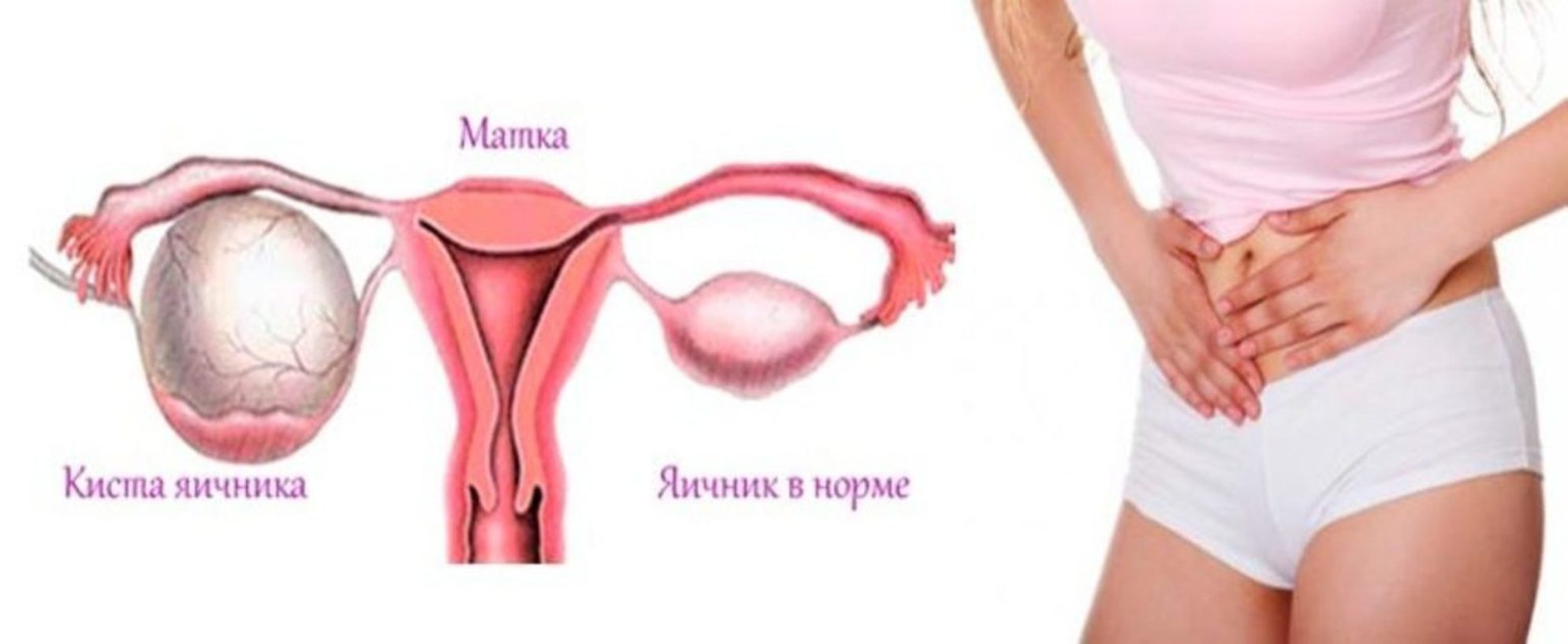 Расположение матки и яичников