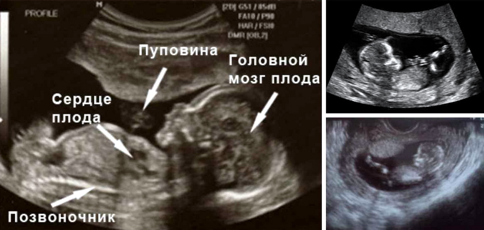 14 недель беременности грудь форум фото 30