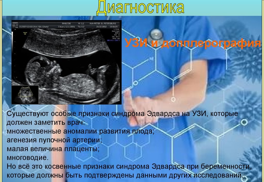 Skrining Pri Vagitnosti 67 Foto Sho Ce Take Yak Jogo Roblyat Na Yakih Terminah Roblyat Prenatalnij Vid Termini Ta Meti Provedennya Diagnostika Ta Rezultati Rozshifrovka Analiziv Ta Obstezhennya Plodu Pidgotovka