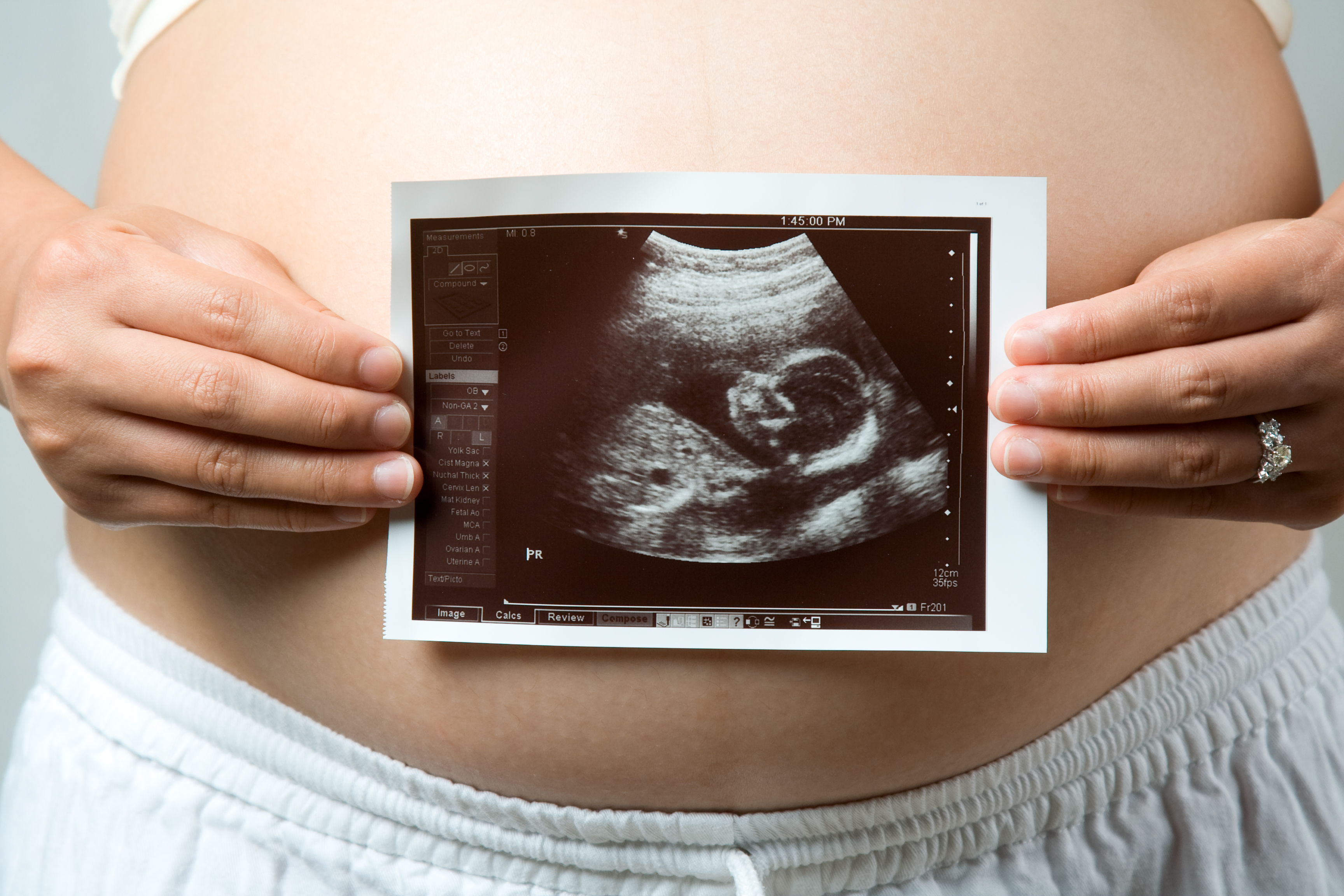 8 12 неделя беременности. УЗИ 1 триместр беременности скрининг. УЗИ первый скрининг беременности. УЗИ беременности 1 скрининг. Скрининговое УЗИ 2 триместра.